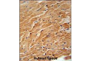 CCL21 Antibody immunohistochemistry analysis in formalin fixed and paraffin embedded mouse heart tissue followed by peroxidase conjugation of the secondary antibody and DAB staining. (CCL21 antibody  (AA 23-52))