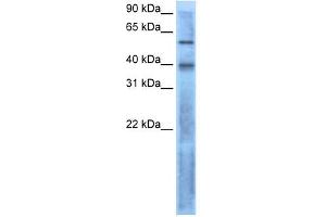 LEFTY2 antibody used at 1 ug/ml to detect target protein. (LEFTY2 antibody  (N-Term))