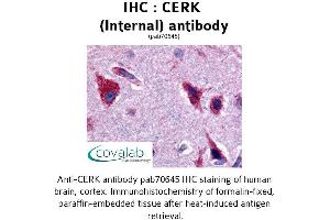 Image no. 1 for anti-Ceramide Kinase (CERK) (Internal Region) antibody (ABIN1733019) (CERK antibody  (Internal Region))