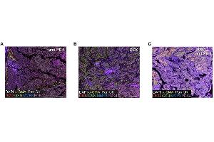 Representative images show combined expression of all markers for (A) anti-PD-1, (B) doxorubicin (DOX), and (C) DOX plus anti-PD-1 treated tumors. (PDK4 antibody  (AA 382-410))