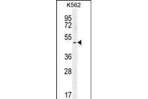 T-Box 6抗体（C-Term）