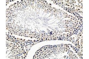 ABIN7096518 and ABIN7100582 at 1/100 staining rat testis tissue by IHC-P. (OSBPL11 antibody)