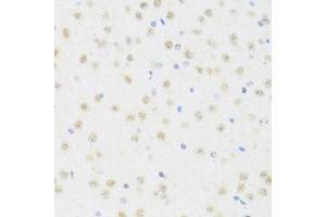 Immunohistochemistry of paraffin-embedded mouse brain using DDX50 antibody (ABIN6129371, ABIN6139509, ABIN6139510 and ABIN6224730) at dilution of 1:100 (40x lens).