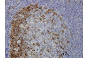 Immunoperoxidase of monoclonal antibody to TACC3 on formalin-fixed paraffin-embedded human tonsil. (TACC3 antibody  (AA 1-100))