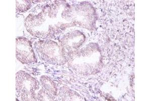 Immunohistochemistry of paraffin-embedded human prostate tissue using ABIN7142202 at dilution of 1:100