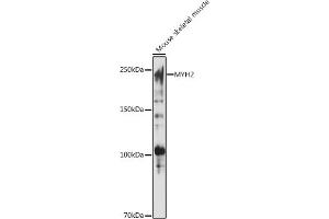 Western blot analysis of extracts of Mouse skeletal muscle, using MYH2 antibody (ABIN7268748) at 1:1000 dilution. (MYH2 antibody  (AA 550-650))