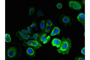 Immunofluorescent analysis of MCF-7 cells using ABIN7151978 at dilution of 1:100 and Alexa Fluor 488-congugated AffiniPure Goat Anti-Rabbit IgG(H+L) (TMEM93 antibody  (AA 2-47))