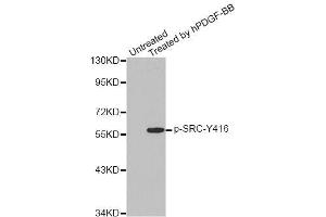 Western blot analysis of extracts from COLO205 cells, using Phospho-SRC-Y418 antibody (ABIN5969963). (Src antibody  (pTyr418))