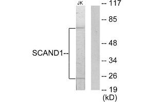 Western blot analysis of extracts from Jurkat cells, using SCAND1 antibody. (SCAND1 antibody  (Internal Region))