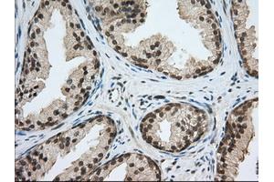 Immunohistochemical staining of paraffin-embedded Human liver tissue using anti-PDE4A mouse monoclonal antibody. (PDE4A antibody)