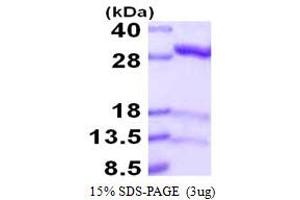 SDS-PAGE (SDS) image for Isopentenyl-Diphosphate delta Isomerase 1 (IDI1) (AA 1-228) protein (His tag) (ABIN667974) (IDI1 Protein (AA 1-228) (His tag))