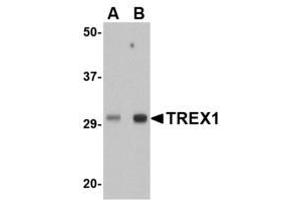 Image no. 1 for anti-three Prime Repair Exonuclease 1 (TREX1) (Internal Region) antibody (ABIN341718) (TREX1 antibody  (Internal Region))