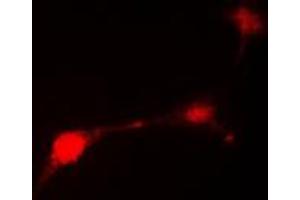Immunofluorescent analysis of Parkin staining in HepG2 cells. (Parkin antibody  (N-Term))