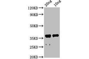 Western Blot Positive WB detected in Recombinant protein All lanes: ache antibody at 2. (Acetylcholinesterase antibody  (AA 37-155))