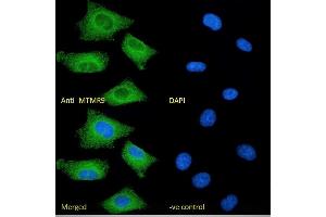 (ABIN184635) Immunofluorescence analysis of paraformaldehyde fixed A549 cells, permeabilized with 0.