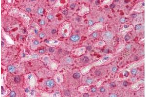 Human Liver (formalin-fixed, paraffin-embedded) stained with HP antibody ABIN214318 at 0. (Haptoglobin antibody)