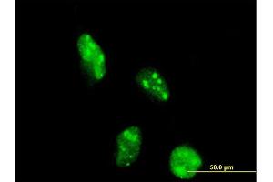 Immunofluorescence of monoclonal antibody to DOT1L on HeLa cell. (DOT1L antibody  (AA 3-108))