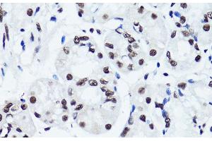 Immunohistochemistry of paraffin-embedded Human stomach using Symmetric DiMethyl-Histone H3-R2 Polyclonal Antibody at dilution of 1:100 (40x lens). (Histone 3 antibody  (H3R2me2s))