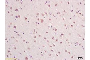Immunohistochemistry (Paraffin-embedded Sections) (IHC (p)) image for anti-Interferon alpha/beta Receptor 2 (IFNAR2) (AA 165-260) antibody (ABIN721825)