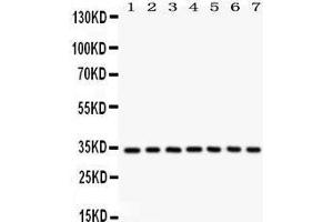 Western Blotting (WB) image for anti-Cyclin-Dependent Kinase 2 (CDK2) (AA 81-298) antibody (ABIN3043472) (CDK2 antibody  (AA 81-298))