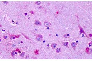 OR6N1 antibody  (Extracellular Domain)