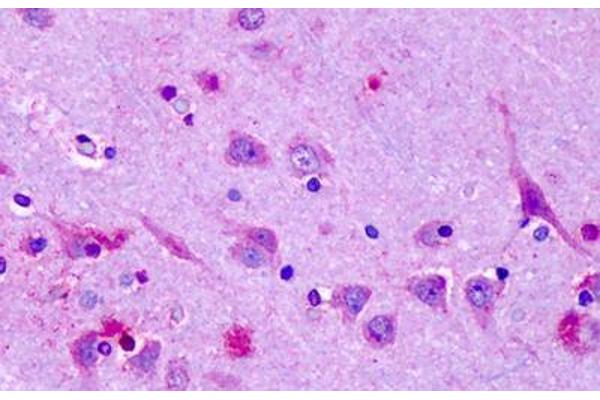 OR6N1 antibody  (Extracellular Domain)