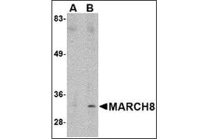 Western blot analysis of MARCH8 in HeLa cell lysate with this product at (A) 0. (MARCH8 antibody  (C-Term))