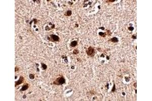 Immunohistochemistry (IHC) image for anti-SLIT and NTRK-Like Family, Member 5 (SLITRK5) (Middle Region 1) antibody (ABIN1031190) (SLITRK5 antibody  (Middle Region 1))