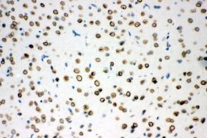 IHC analysis of Sumo 1/SUMO1 using anti-Sumo 1/SUMO1 antibody (ABIN7603002).
