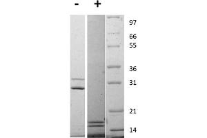 SDS-PAGE of Rat Interleukin-17AF Heterodimer Recombinant Protein SDS-PAGE of Rat Interleukin-17 Animal Free Recombinant Protein. (IL-17A/F Protein)