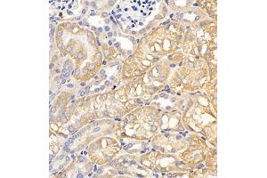Immunohistochemistry of paraffin embedded mouse kidney using Clcn5 (ABIN7073471) at dilution of 1:200 (400x lens)