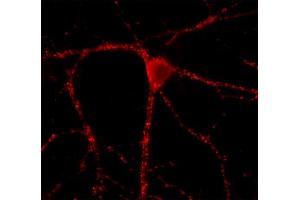 Immunolabeling of cultured hippocampus neurons (dilution 1 : 500). (GAD65 antibody  (AA 3-96))