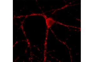 Immunolabeling of cultured hippocampus neurons (dilution 1 : 500). (GAD65 antibody  (AA 3-96))
