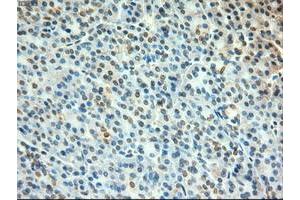Image no. 1 for anti-Myc Proto-Oncogene protein (MYC) antibody (ABIN1497011) (c-MYC antibody)