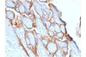 Formalin-fixed, paraffin-embedded human placenta stained with HCG-beta Rabbit Recombinant Monoclonal Antibody (HCGb/1996R). (Recombinant CGB antibody)