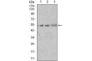 Western blot analysis using SPIB mouse mAb against A549 (1), PC-3 (2), and NIH3T3 (3) cell lysate. (SPIB antibody  (AA 200-252))