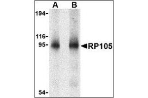 Western blot analysis of RP105 in human spleen tissue lysate with this product at (A) 0.