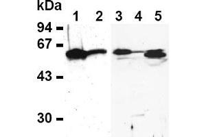 Western Blotting (WB) image for anti-E2F Transcription Factor 4, P107/p130-Binding (E2F4) antibody (ABIN487490) (E2F4 antibody)