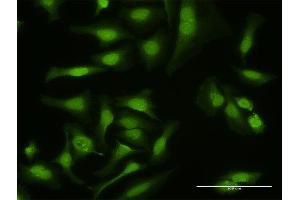 Immunofluorescence of purified MaxPab antibody to MAP3K14 on HeLa cell.