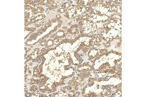 IHC analysis of TXNDC5 using anti-TXNDC5 antibody (ABIN7599699). (TXNDC5 antibody  (AA 109-403))