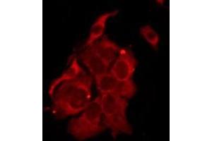 ABIN6276221 staining MCF7 by IF/ICC. (TAS2R14 antibody  (Internal Region))