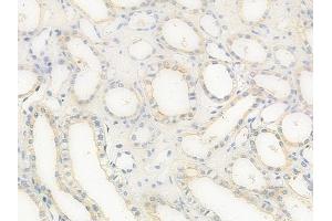 ABIN6258203 and ABIN6273889 at 1/100 staining human normal kidney tissue by IHC-P.