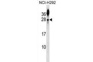 TSPAN2 Antibody (N-term) western blot analysis in NCI-H292 cell line lysates (35 µg/lane). (Tetraspanin 2 antibody  (N-Term))