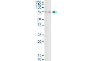 RNF12 monoclonal antibody (M01), clone 1G10. (RLIM antibody  (AA 1-83))