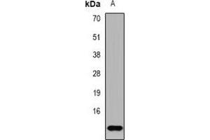 Western blot analysis of TF2A2 expression in NCIH460 (A) whole cell lysates.