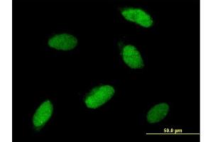 Immunofluorescence of purified MaxPab antibody to SNAI1 on HeLa cell. (SNAIL antibody  (AA 1-264))