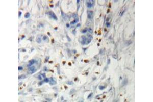 IHC-P analysis of pancreas tissue, with DAB staining.