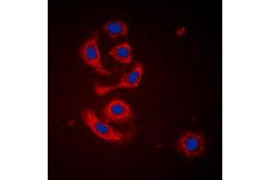 Immunofluorescent analysis of Calreticulin staining in HeLa cells. (Calreticulin antibody  (N-Term))