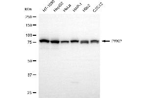 Western blotting analysis using PFKP antibody (ABIN7799804).
