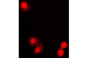 Immunofluorescent analysis of PML staining in COLO320 cells.